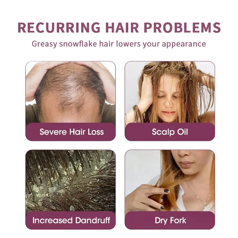 Garlic anti-dandruff shampoo